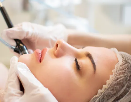 Mikrodermabrasion